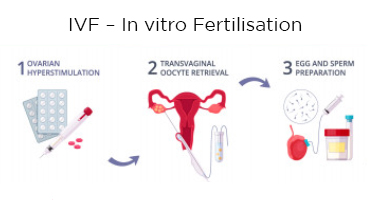 FIV - Fecundación in vitro