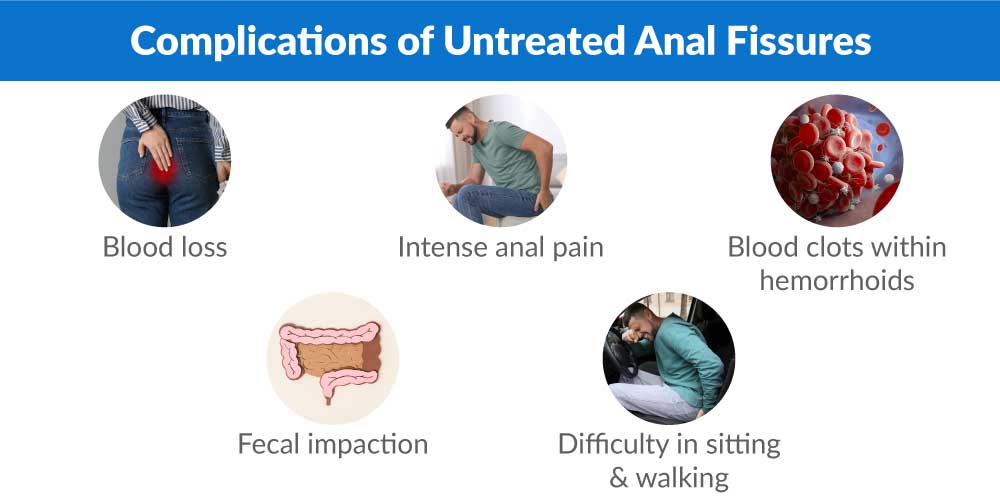 complications of anal fissure