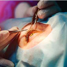 Best Hospitals for Ophthalmology Treatment in Turkey