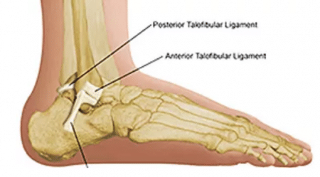 Cirugía de corrección de la deformidad del pie y tobillo