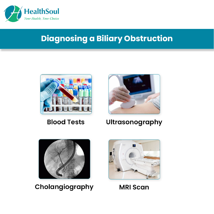 diagnosis of biliary duct obstruction