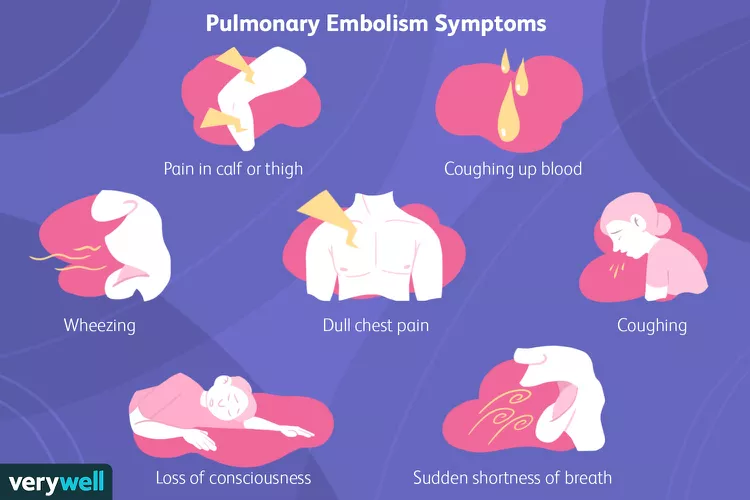 symptômes d'embolie pulmonaire