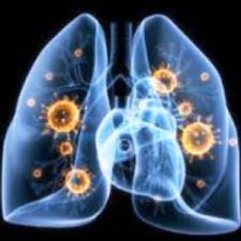 Berufsbedingte Lungenkrankheit