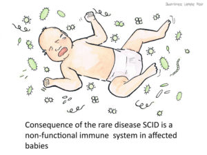  Severe Combined Immunodeficiency Disease (SCID)