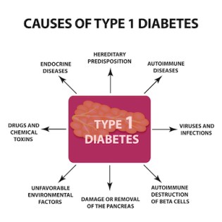 causes of type 1 diabetes mellitus