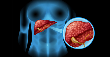Lymphoma of the Liver