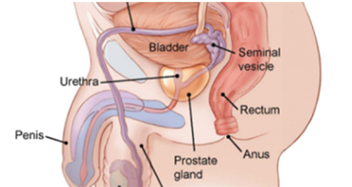 Ein Überblick: Prostatakrebs