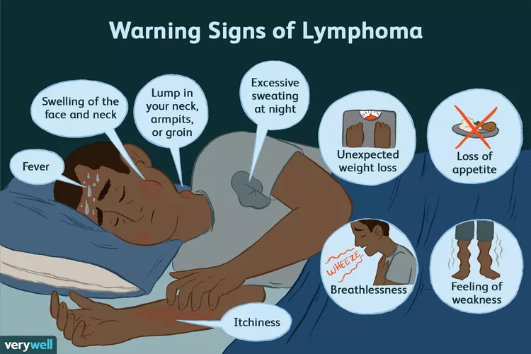 Warning signs of lymphoma of the liver