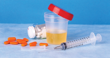 The Use Of Urinalysis In The Diagnosis Of Medical Conditions