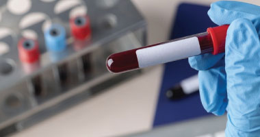 Blood Protein Test