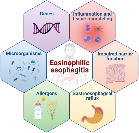 Eosinophilic Esophagitis risk factors