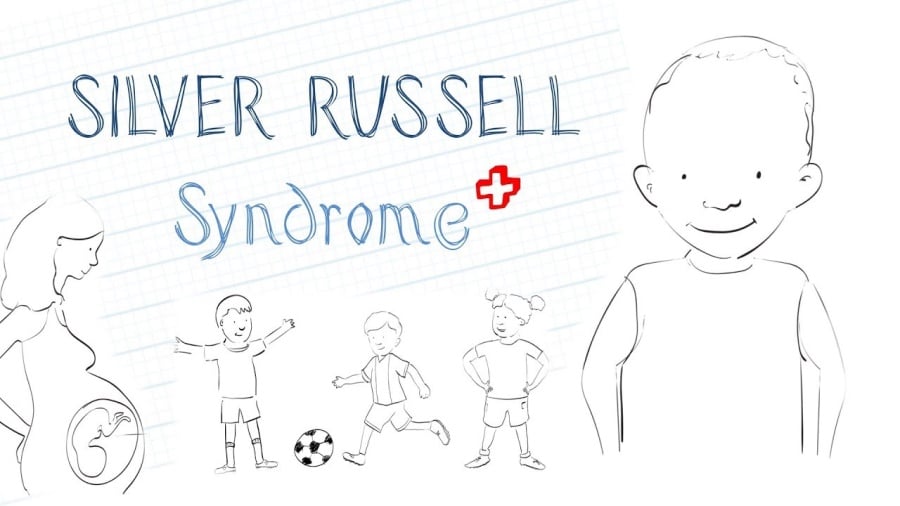 Russell Silver Syndrome
