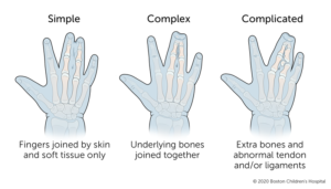 تصنيف اصابع الاصابع
