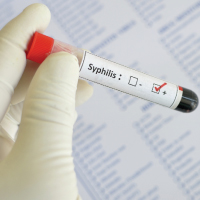 Prueba de sífilis