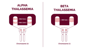 Types of Thalassemia