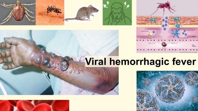 Viral Hemorrhagic Fever