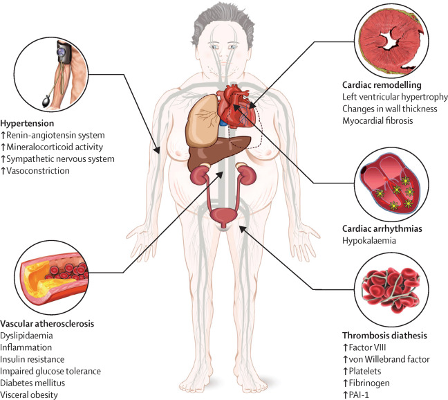 complications associated with Cushing’s syndrome