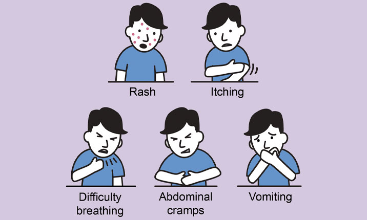 أعراض حساسية الدواء
