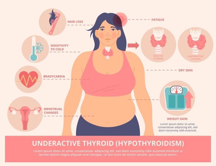 symptoms of hypothyroidism