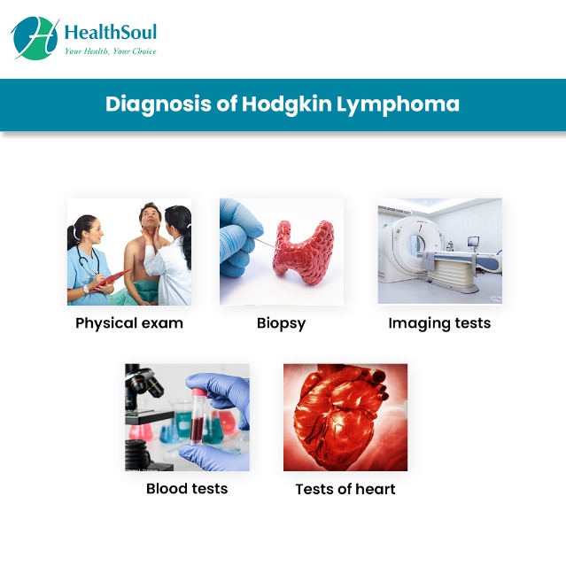 HODGKIN’S LYMPHOMA DIAGNOSIS