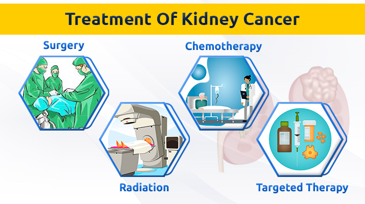 kidney cancer treatments