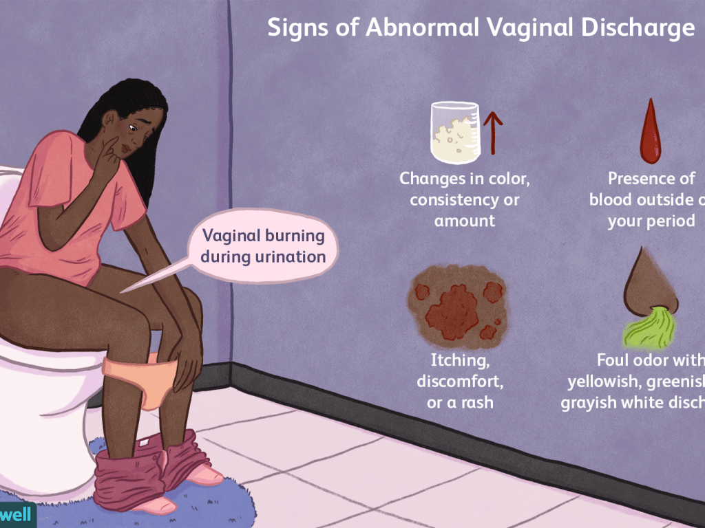 Vaginal Discharge and What Each Color Means
