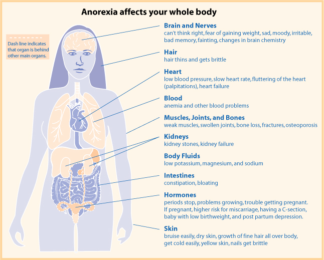 Complications associated with Anorexia Nervosa