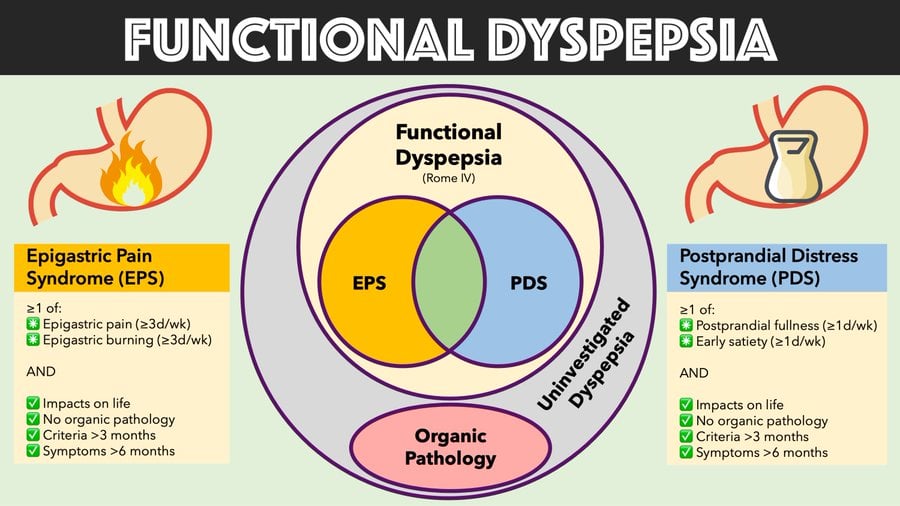 Arten von funktioneller Dyspepsie