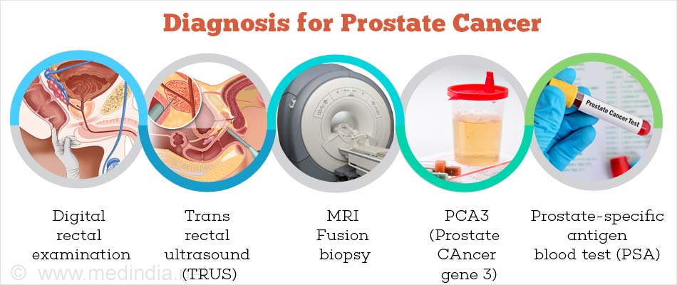 Diagnostic du cancer de la prostate