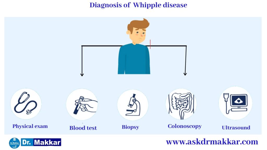 Whipple’s disease diagnosis