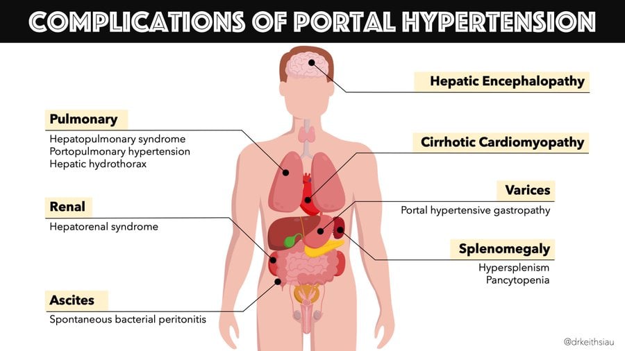 complications of portal hypertension
