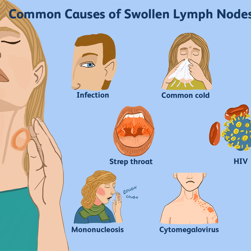 causes of swollen lymph nodes