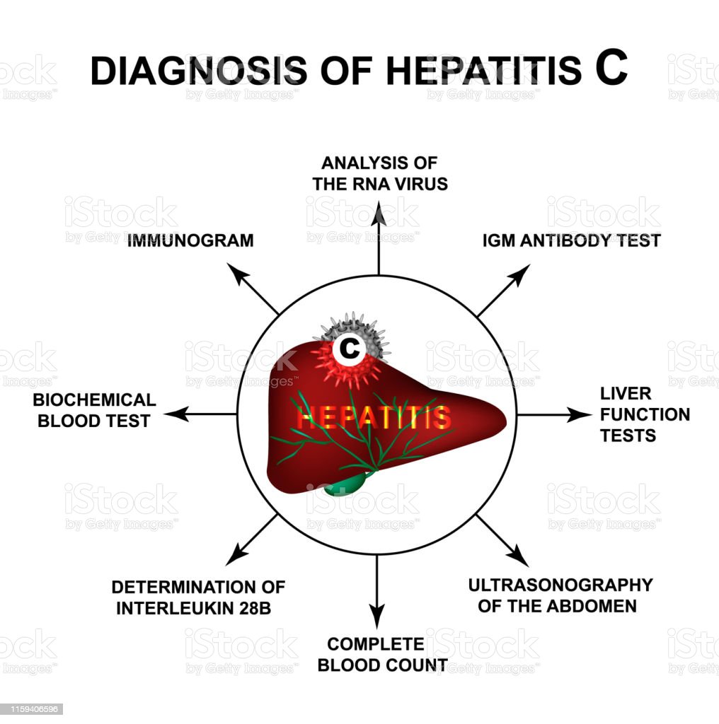 DIAGNOSIS of HEPATITIS -C