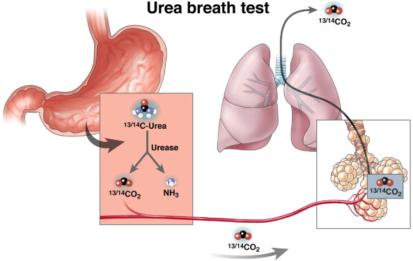 اختبار تنفس اليوريا