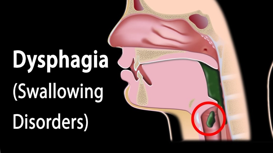 What is dysphagia