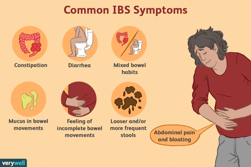 symptoms of irritable bowel syndrome