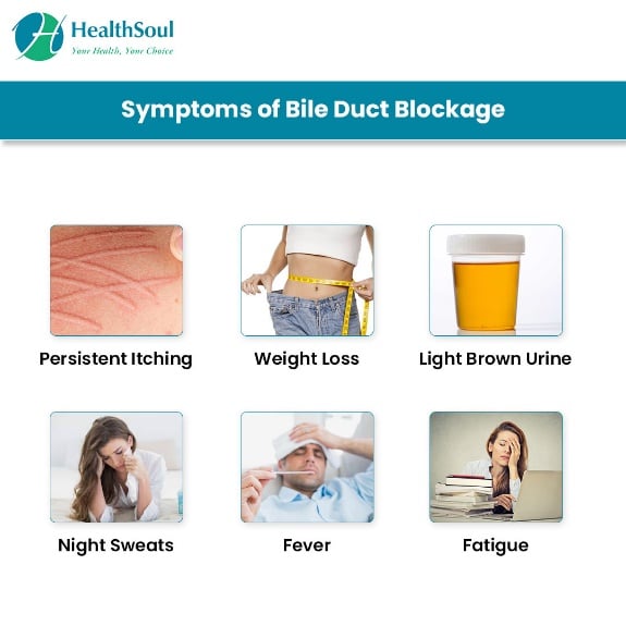 symptoms of biliary blockage