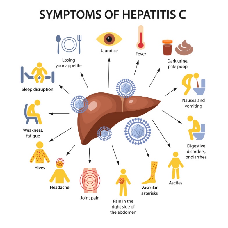 Symptome von Hepatitis C