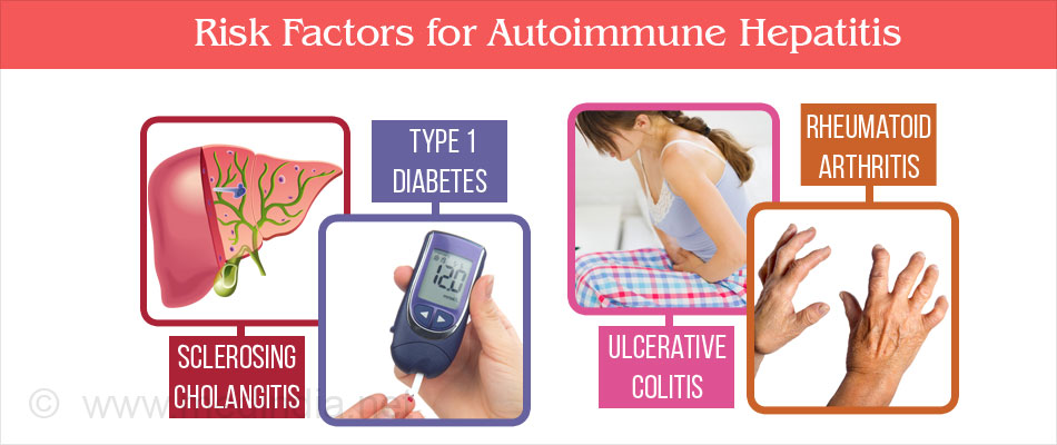 Autoimmune Hepatitis Risk Factors