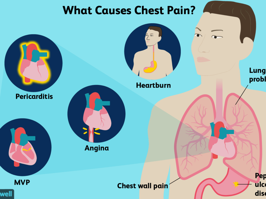 Causes of left chest pain