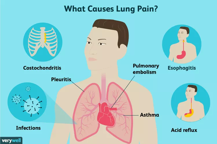 Causes of left chest pain