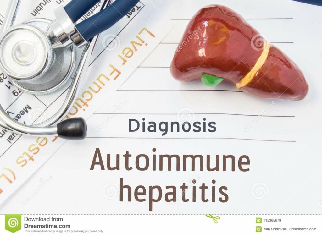 Diagnóstico de la hepatitis autoinmune: