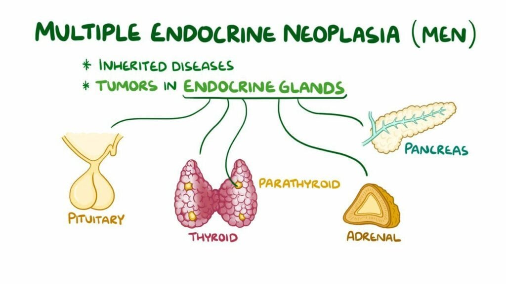 Multiple Endocrine Neoplasia