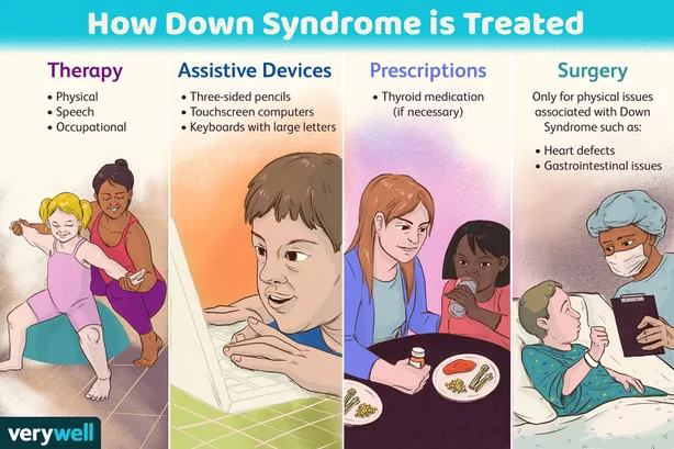 Treatment of down syndrome