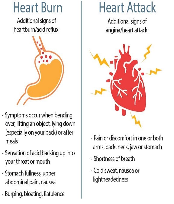acidez estomacal vs infarto