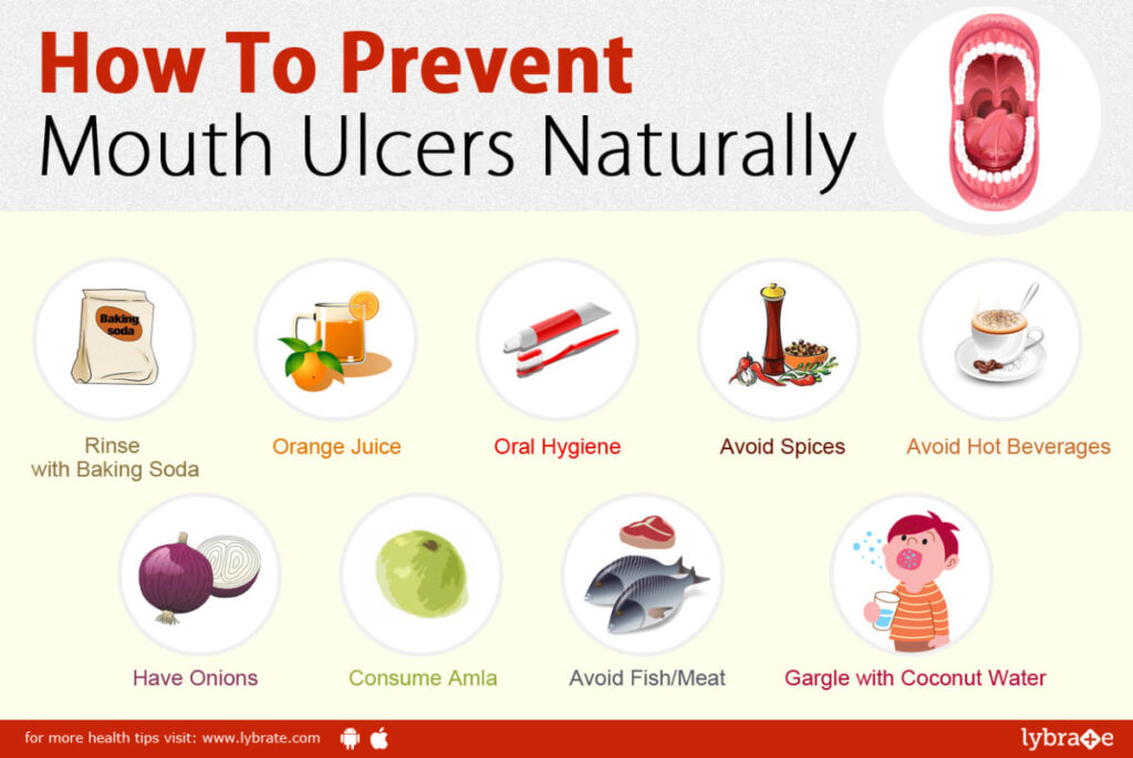 preventing mouth ulcers naturally
