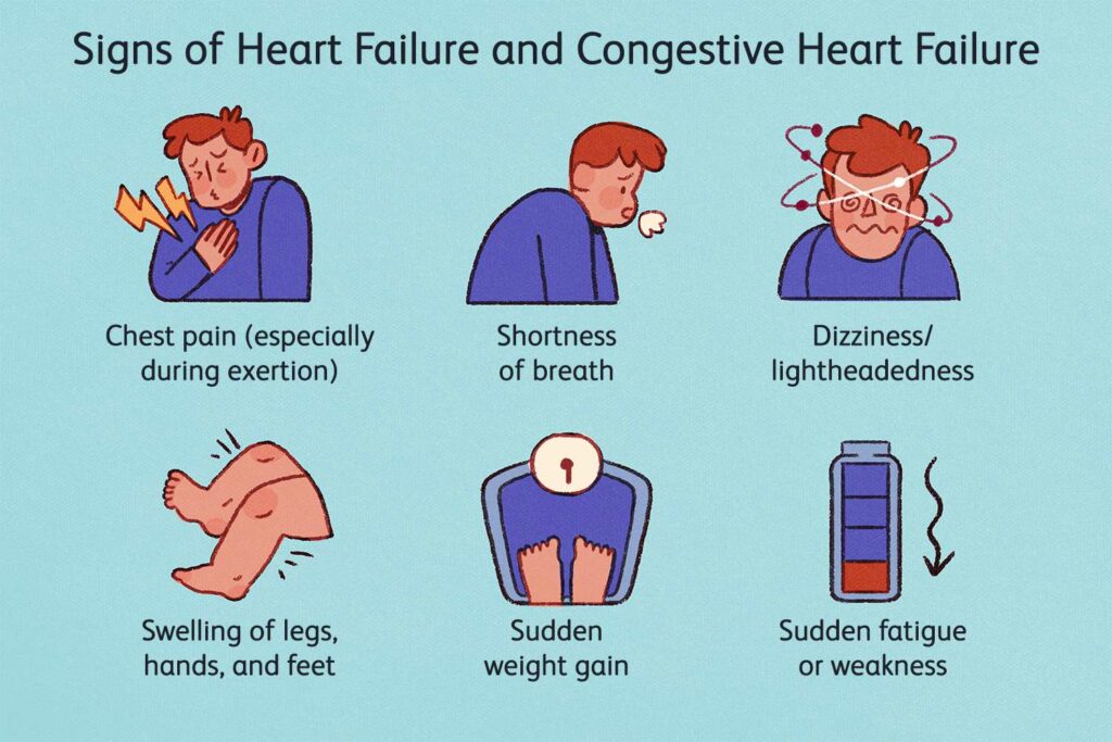 symptoms-and-signs-of-congestive-heart-failure