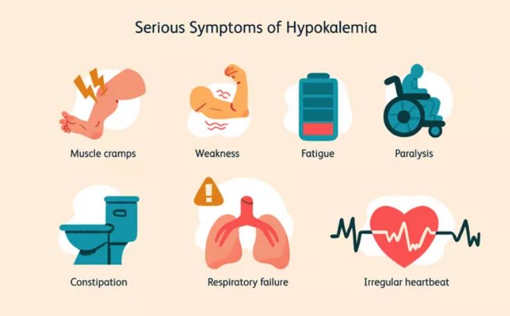 Hypokalemia symptoms 