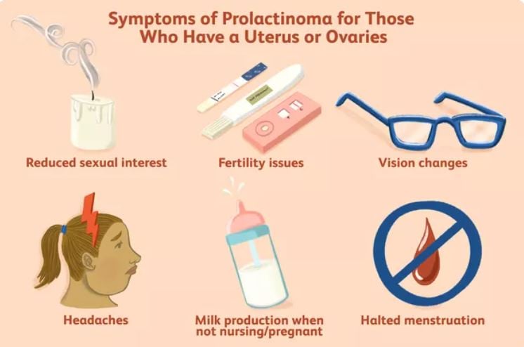 Prolactinoma symptoms in women
