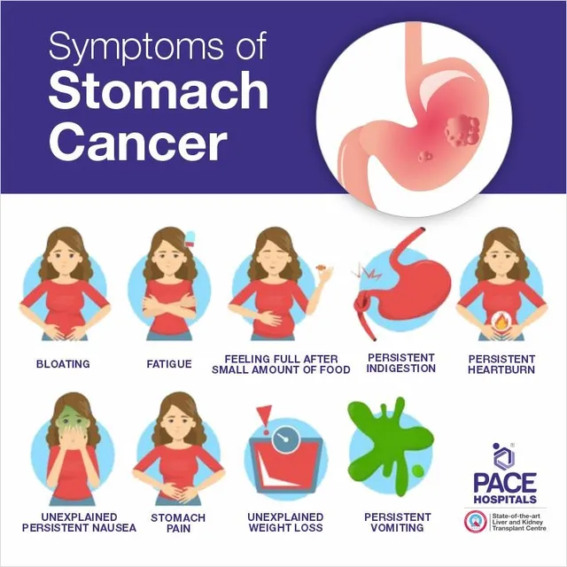 symptoms of stomach cancer